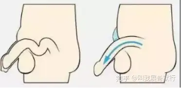 网上那么多增大增粗产品有没有朋友亲身用过靠谱的产品