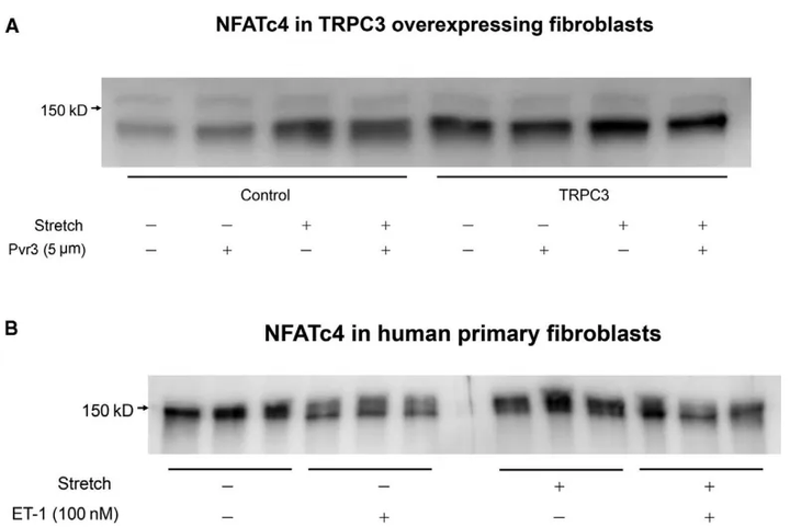 拉伸通過增強成纖維細胞中內皮素受體B和TRPC3 的表達來促進傷口收縮