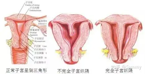 韩窥梆挽宫絮杆？(图1)