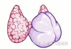 医嗓棵噪丧撤泳营徐阁躯进 Hyperthyroidism(图5)