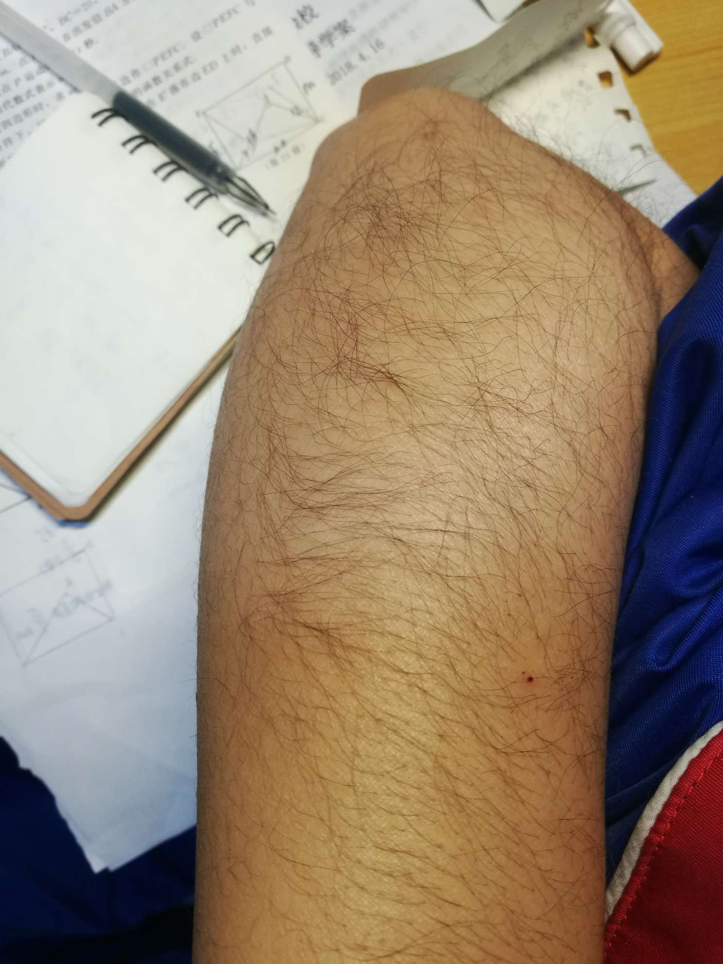 曲奇 的想法: 我是一个初三妹子 胳膊上的汗毛特别重!… - 知乎