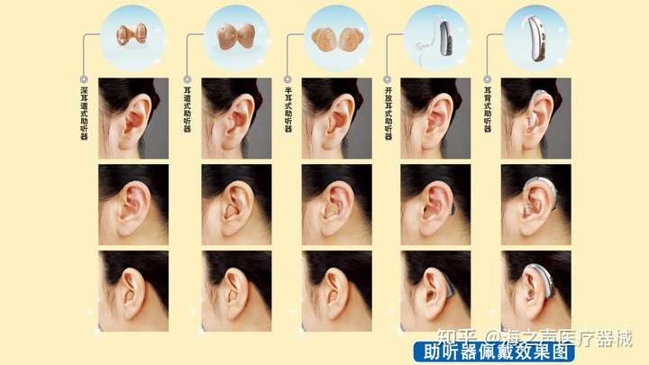 1,助聽器本底噪音:本底噪音對聽力較好或部分頻率較好的用戶影響大,有