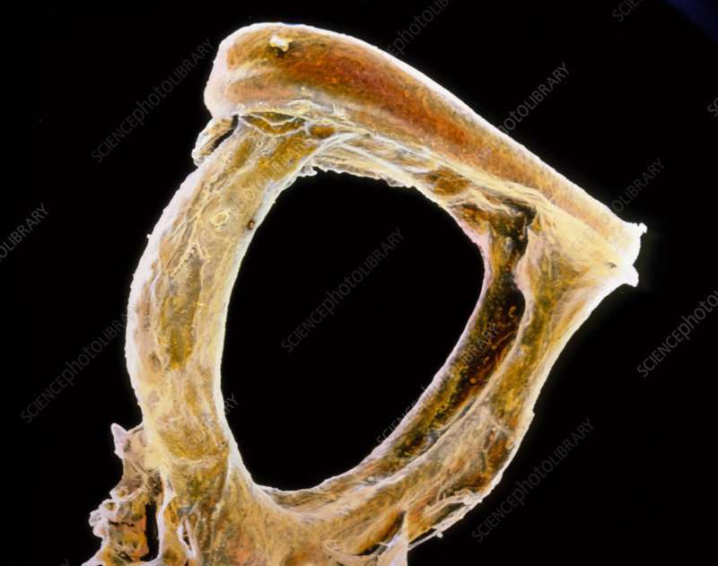人体最小的骨头图片