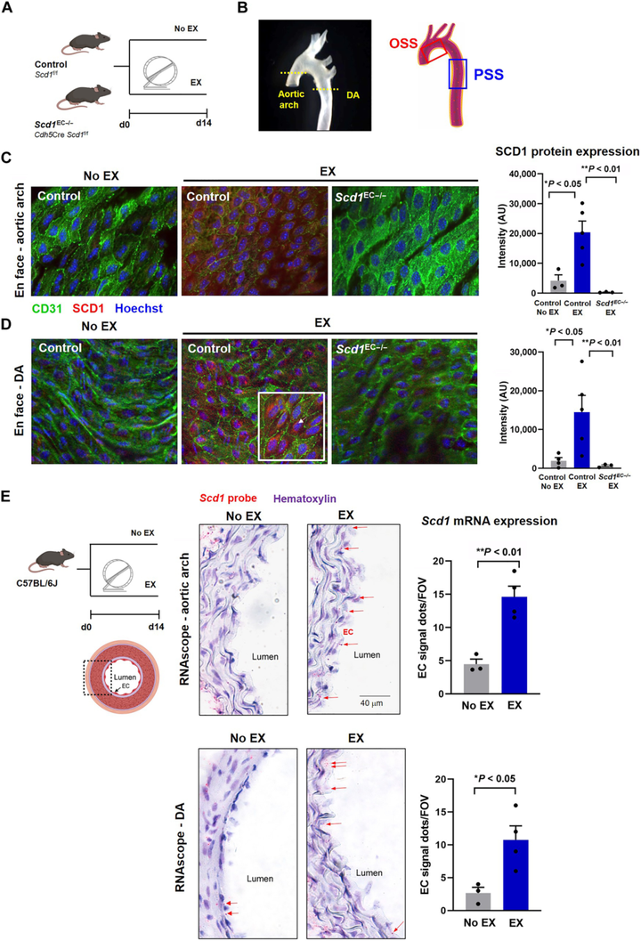 運(yùn)動(dòng)可減輕血流再循環(huán)并激活代謝轉(zhuǎn)能器 SCD1 以催化血管保護(hù)性代謝物