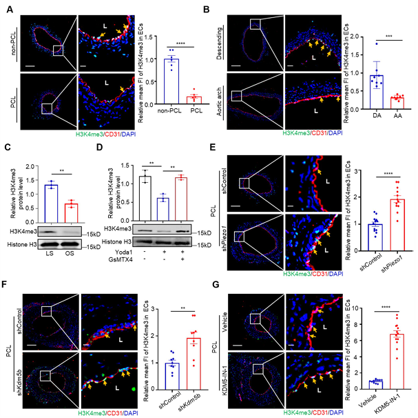 Piezo1 調(diào)控的內(nèi)皮 KDM5B 參與紊亂血流誘導(dǎo)的動(dòng)脈粥樣硬化斑塊形成
