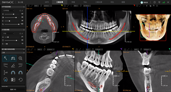 引领口腔行业数字化升级,睿知影口腔智能影像服务,重磅上线