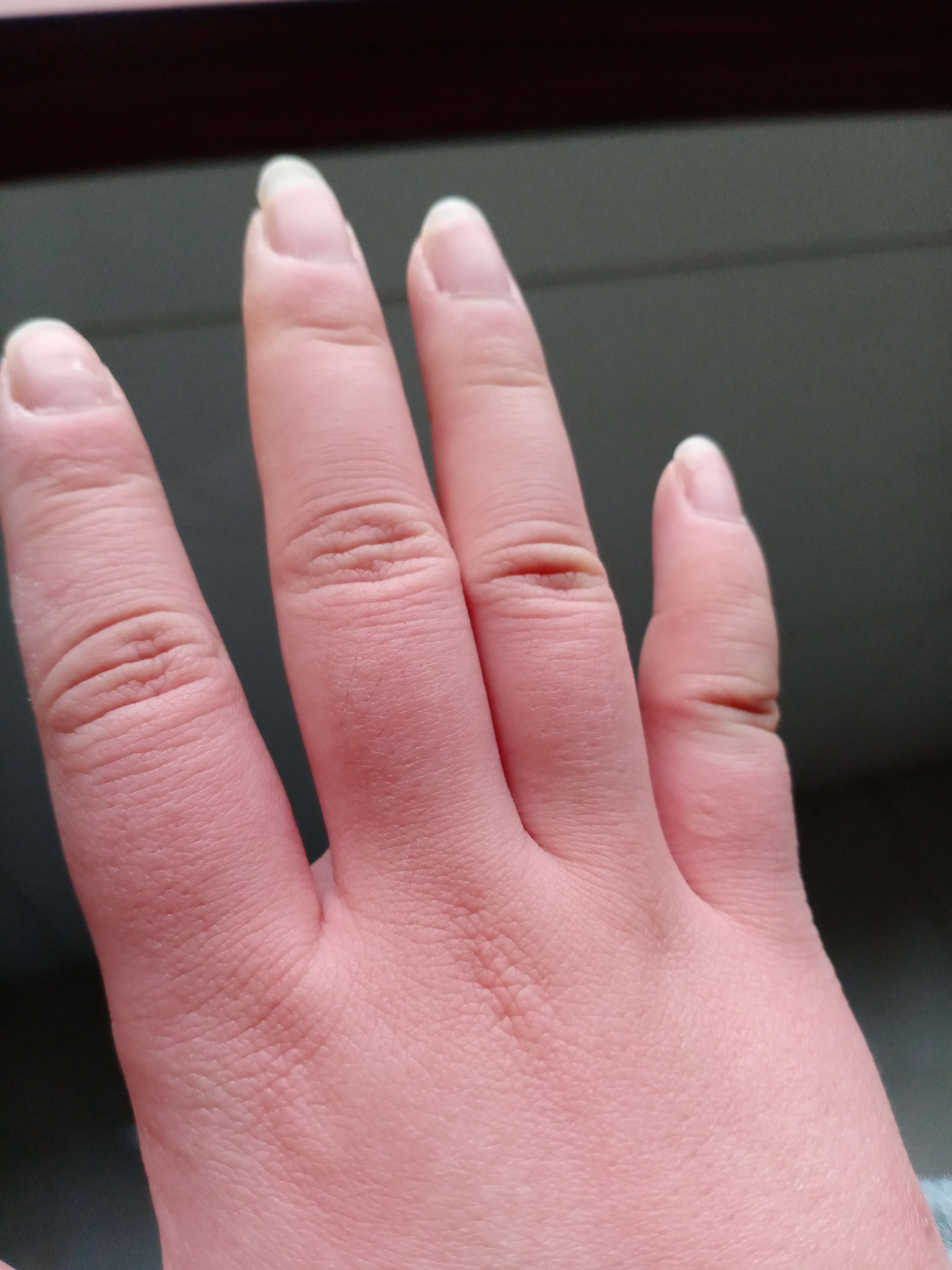 健康 手部的皮肤一… - 知乎