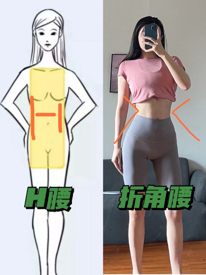 吸脂能吸出折角腰吗?