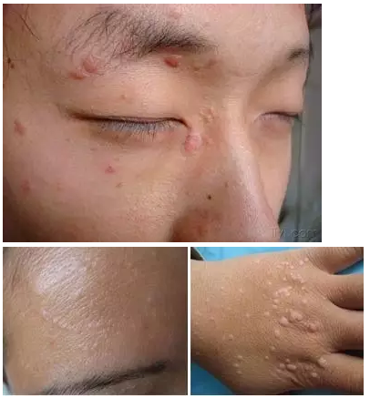 对于有密集恐惧症的我来说,扁皮尤的出现让我不知如何是好,怎么跟它说