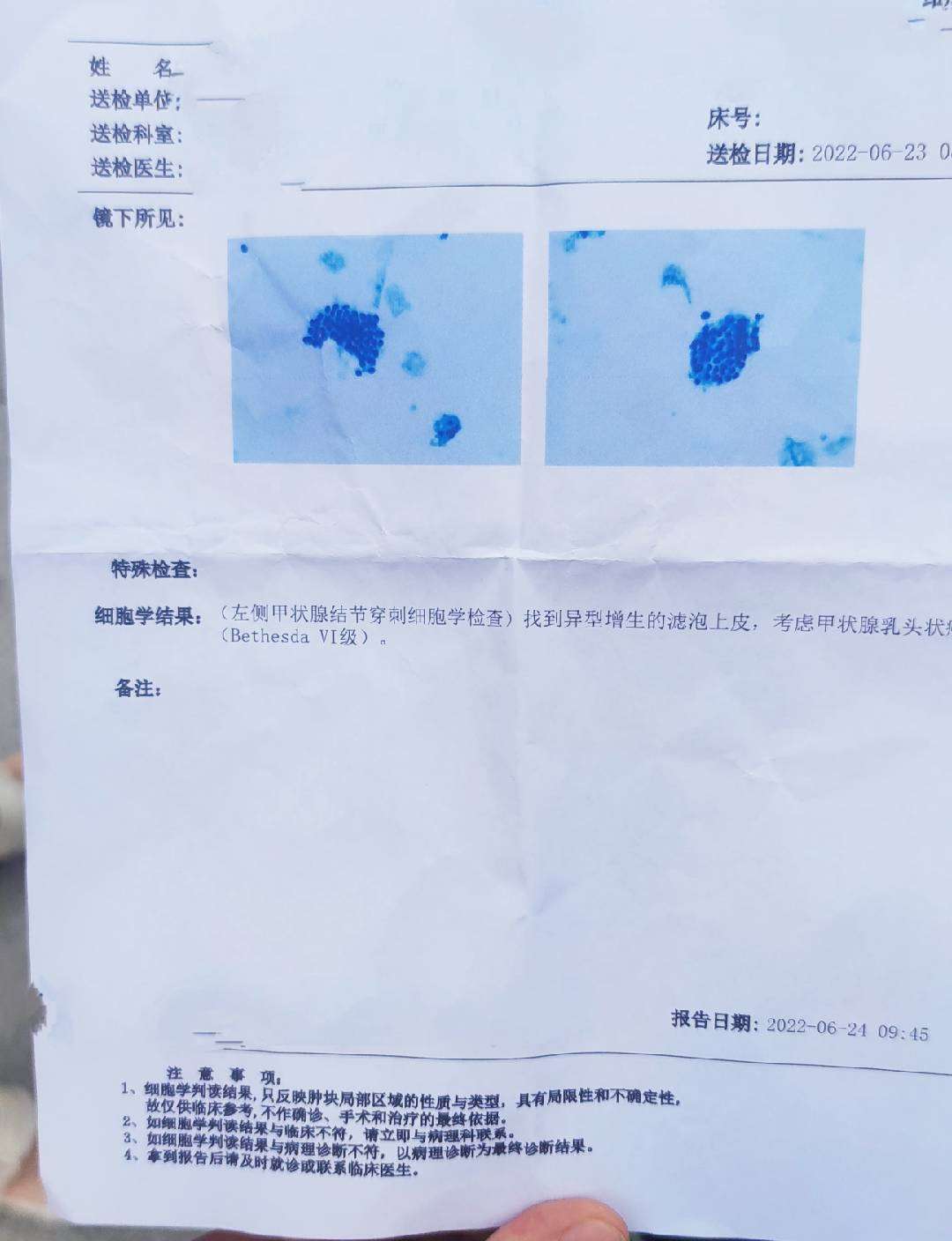 Thyroid Biopsy Report