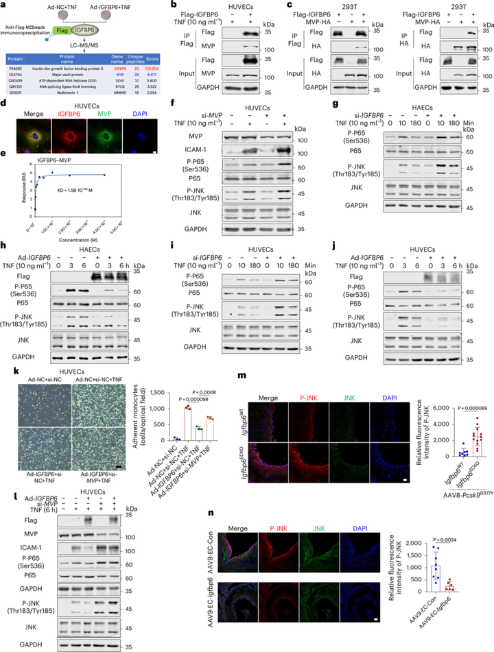 内皮胰岛素样生长因子结合蛋白6（IGFBP6）抑制血管炎症和动脉粥样硬化