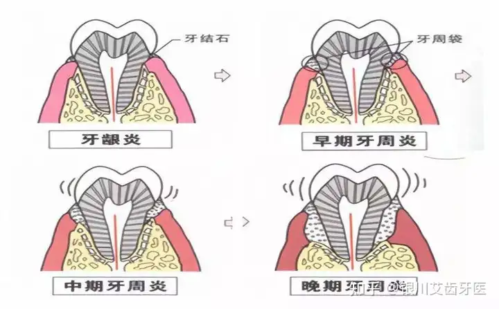 衔揣肌血激身稍孝织题(图1)