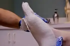 石膏阳模修型与手工制作矫形鞋垫的工艺示意