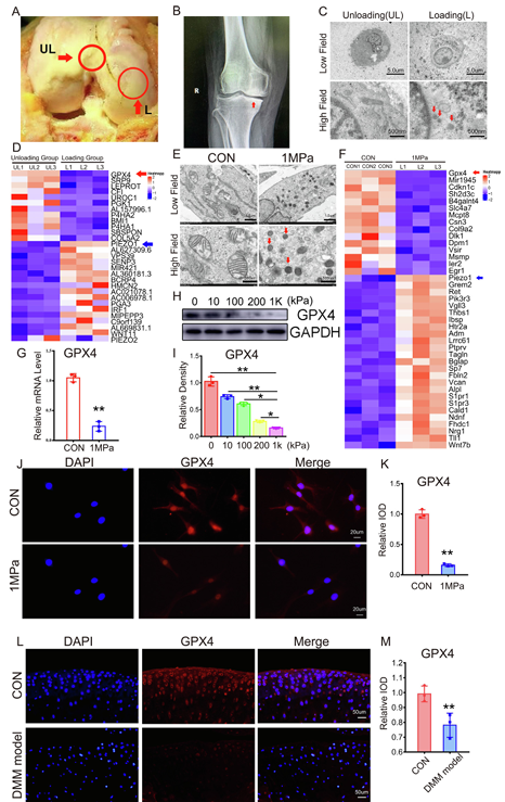 機械超負荷通過 Piezo1 通道促進鈣內流誘導骨關節炎中 GPX4 調節的軟骨細胞鐵死亡 機械超負荷通過 Piezo1 通道促進鈣內流誘導骨關節炎中 GPX4 調節的軟骨細胞鐵死亡