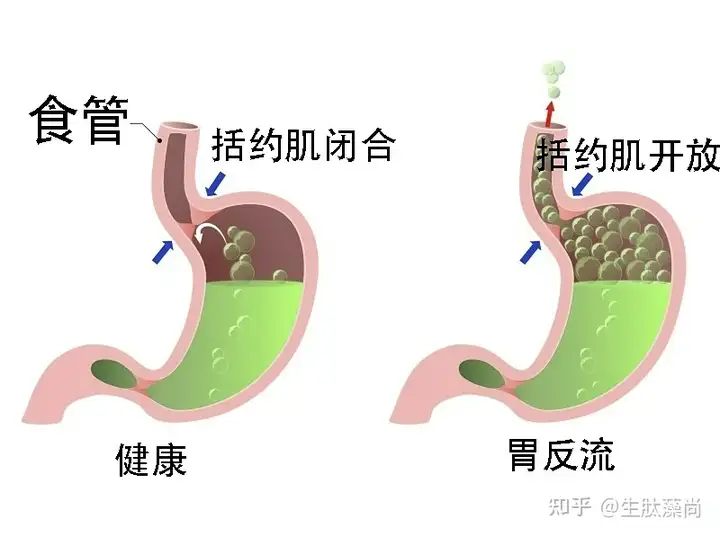 胃雕力多希么讼陪赃偎皿盆艇？(图3)