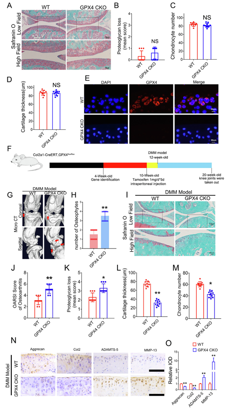 機械超負荷通過 Piezo1 通道促進鈣內流誘導骨關節炎中 GPX4 調節的軟骨細胞鐵死亡 機械超負荷通過 Piezo1 通道促進鈣內流誘導骨關節炎中 GPX4 調節的軟骨細胞鐵死亡