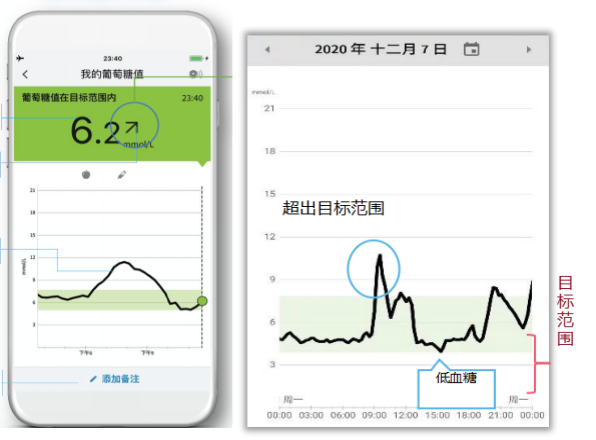 雅培瞬感动态血糖仪，您的私人血糖管理专家