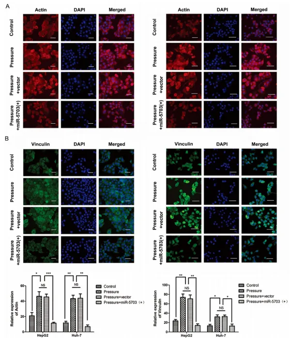 壓力響應(yīng)型 miRNA - 5703 的過(guò)表達(dá)抑制壓力誘導(dǎo)的肝癌生長(zhǎng)和轉(zhuǎn)移