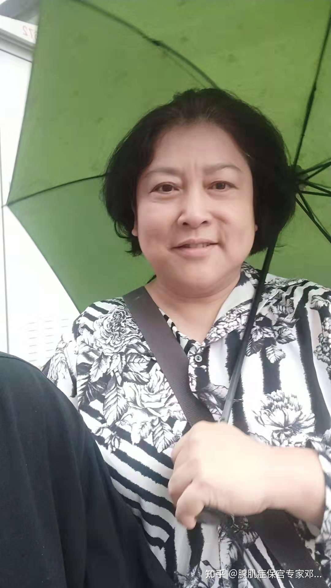 腺肌症保宫专家邓元琪