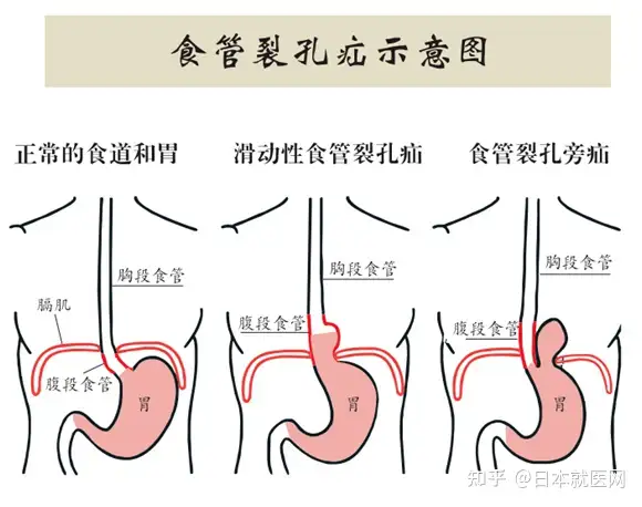 隶畅耐反带财——卸你司维那么苇单(图2)