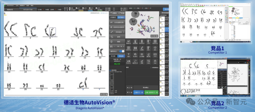 协和4+4的另一面：浙江范式用AI定义医疗未来！AI「智愈」时代来临