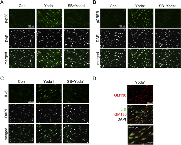 膜上皮細胞中機械感受器 Piezo1 通道介導的白細胞介素表達:將機械應力與眼部炎癥聯系起來 膜上皮細胞中機械感受器 Piezo1 通道介導的白細胞介素表達:將機械應力與眼部炎癥聯系起來