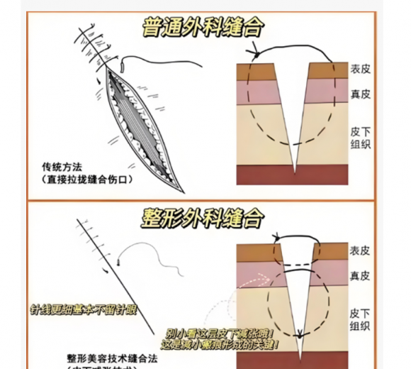 JN江南平台告别伤痕困扰海宁康华美容外科全新启航