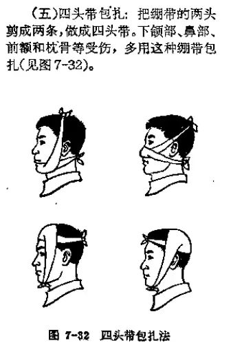 四头带包扎法图片图片