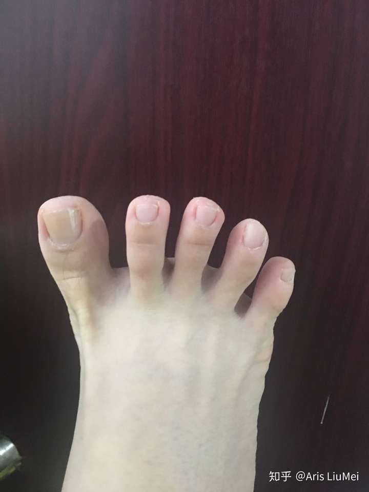 练瑜伽的人真的都能把5个脚趾都张开吗?