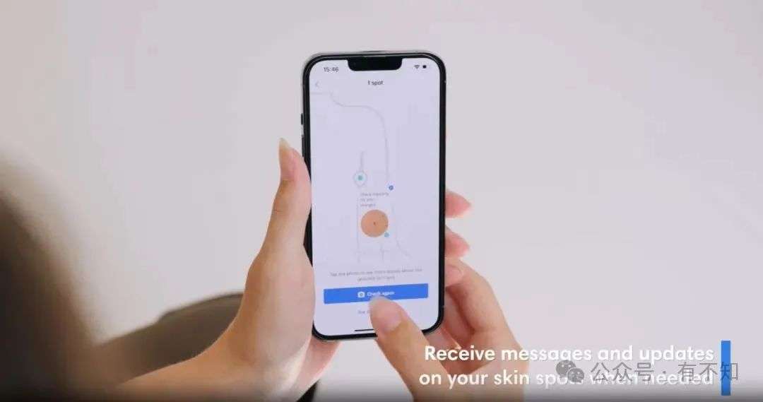革新皮肤检测：SkinVision用AI守护皮肤健康