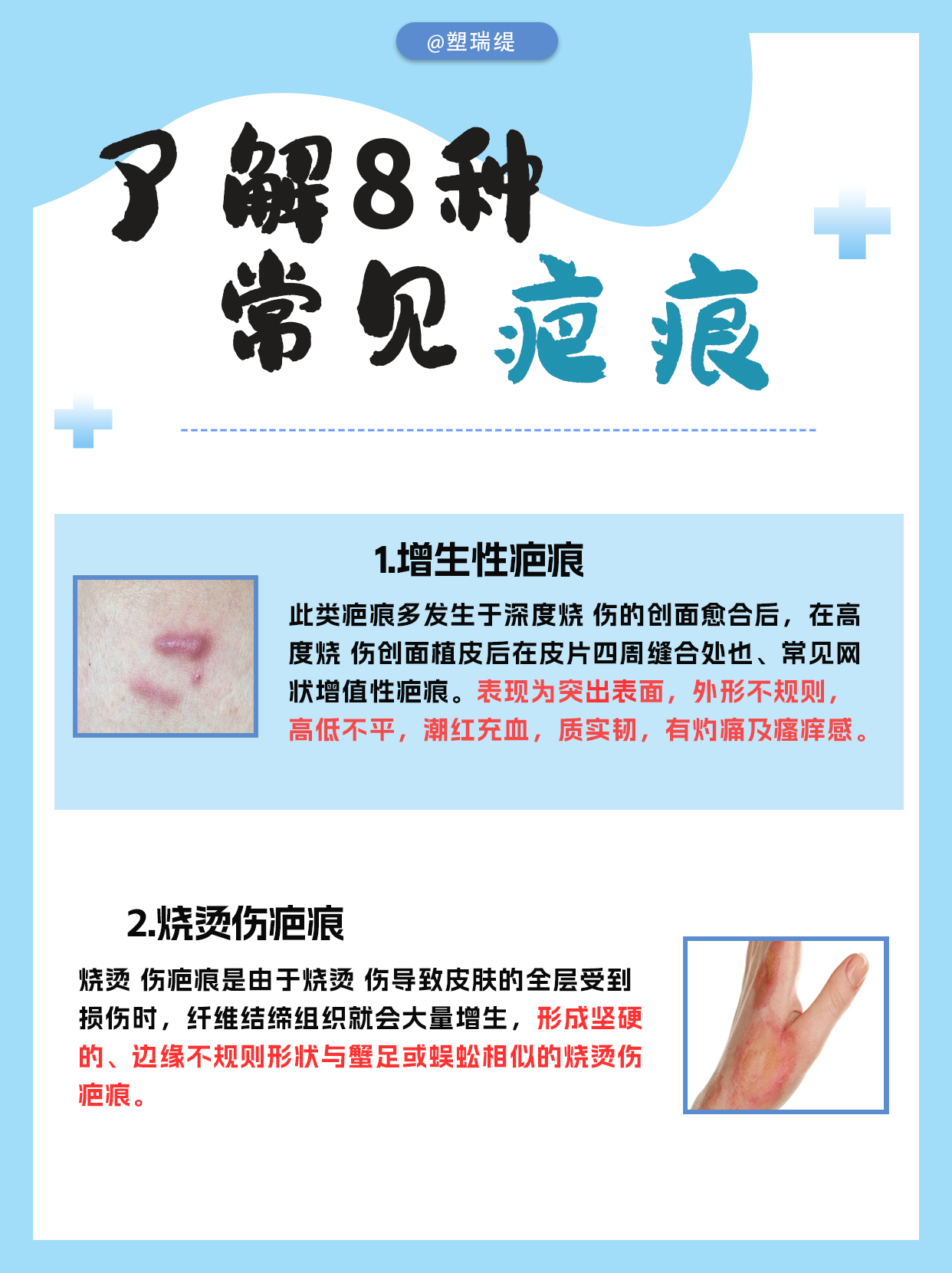 疤痕… - 知乎