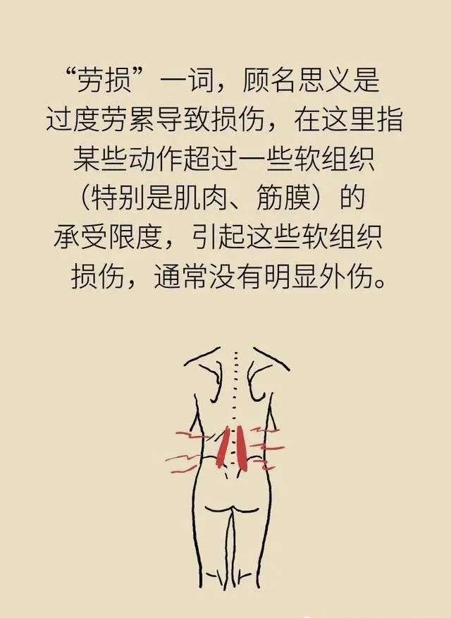 芎芷痛瘀散 的想法: 随着时代的发展,腰肌劳损的发病率正在不