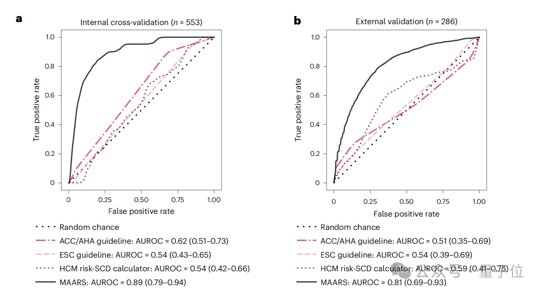 AI发现医生看不见的隐藏心脏病风险，近90%准确率远超人类专家｜Nature子刊