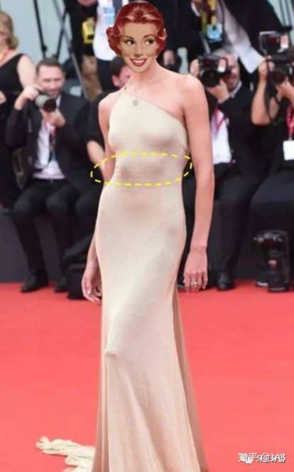 驼背又肋骨外翻怎么办? - 知乎