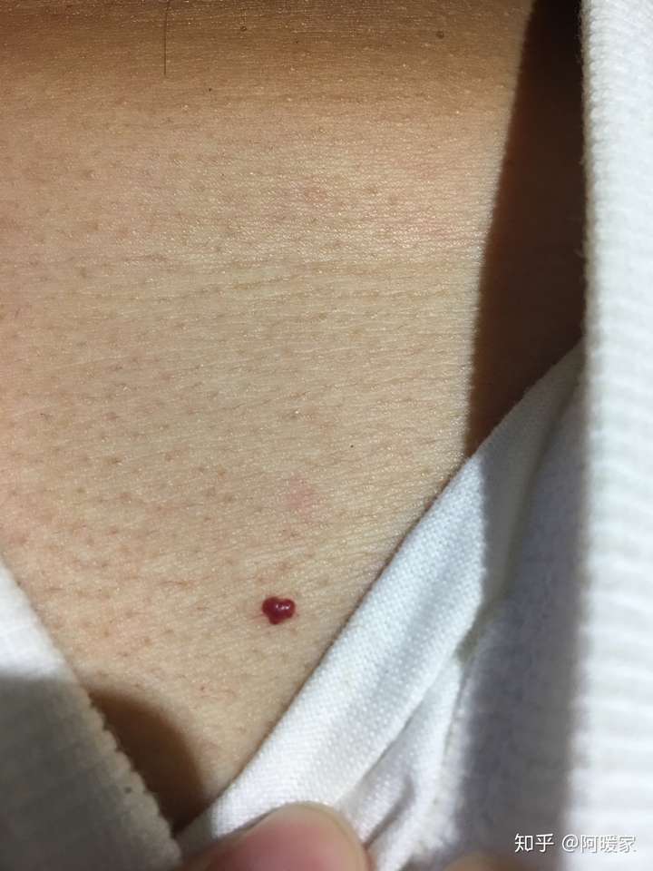 如果你男友心头有另一颗朱砂痣,你会介意吗?