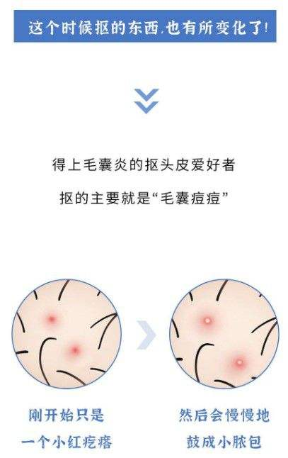 洗發(fā)水推薦排行榜 | 超全深度測評熱門洗發(fā)水：除菌祛痘、去屑止癢、控油蓬松、防脫養(yǎng)發(fā)？最強王者毫無懸洗發(fā)