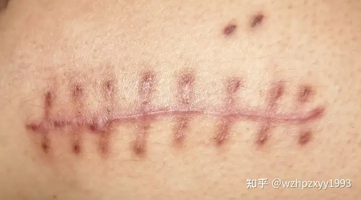 事发温州!一家长深夜驱车3小时,只为孩子这件事