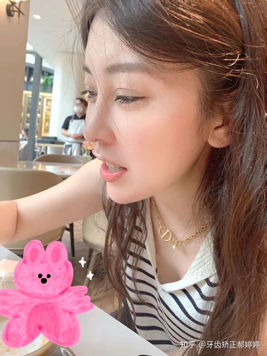 牙齿矫正郝婷婷 的想法: 我的舌侧仙女,变化已经肉眼看到啦 - 知乎