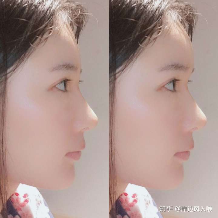 什么样的额头算饱满?