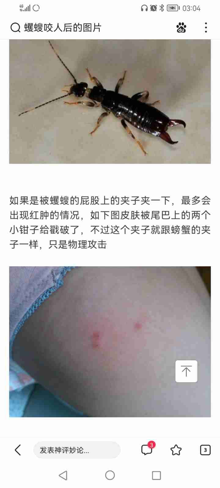 什么虫咬人是两个针眼大小的点?