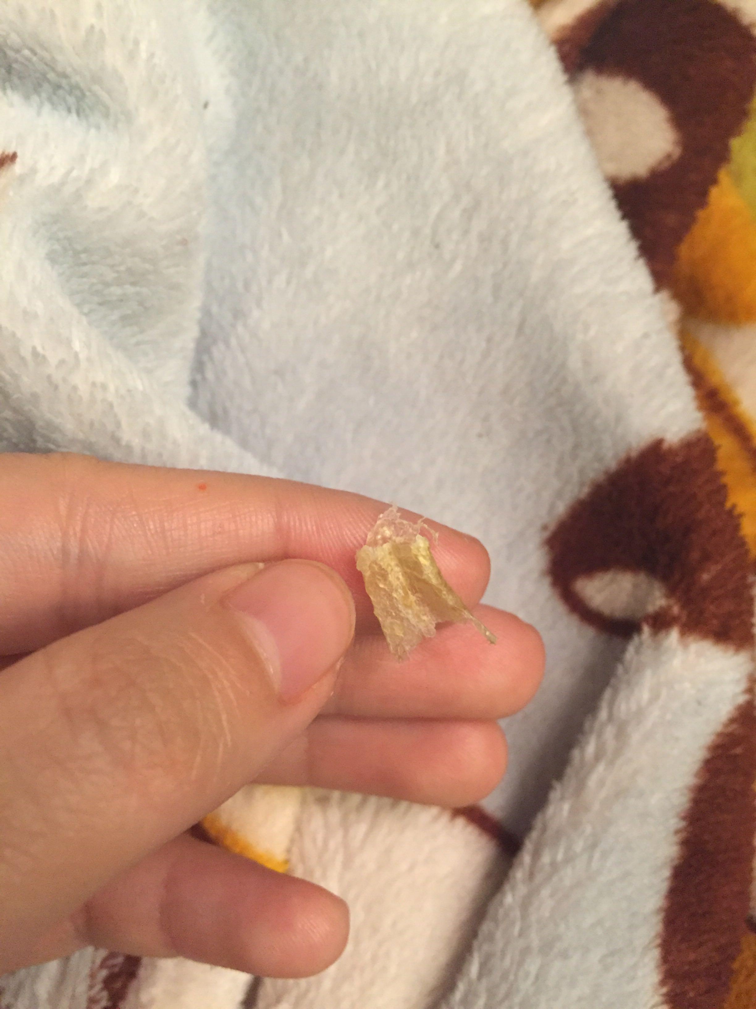 为什么我掏出来的耳屎是桶状的,就是一层薄膜粘附在耳壁上? - 知乎