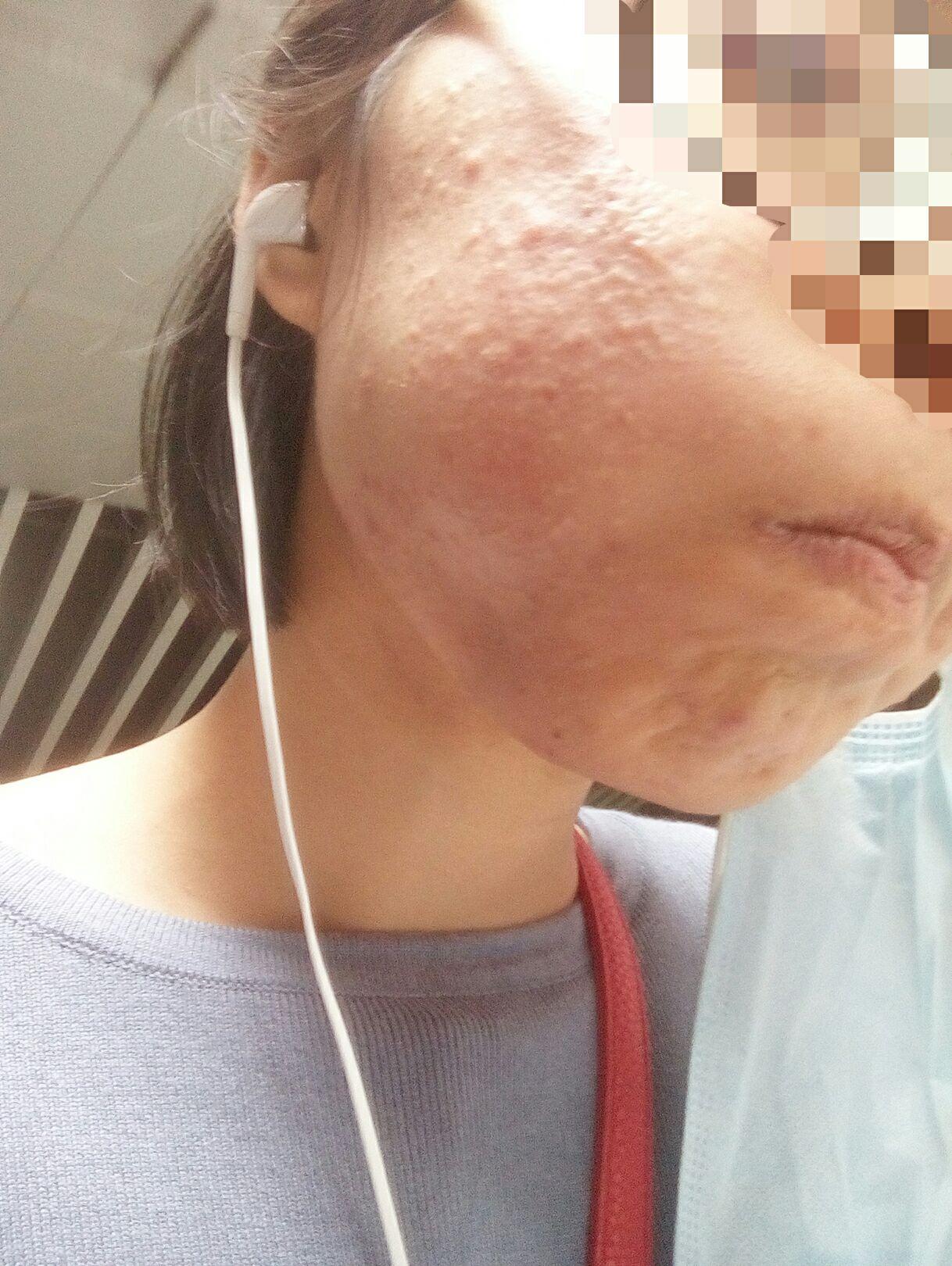 完美玛丽艳的洗面奶真的可以拍出螨虫吗