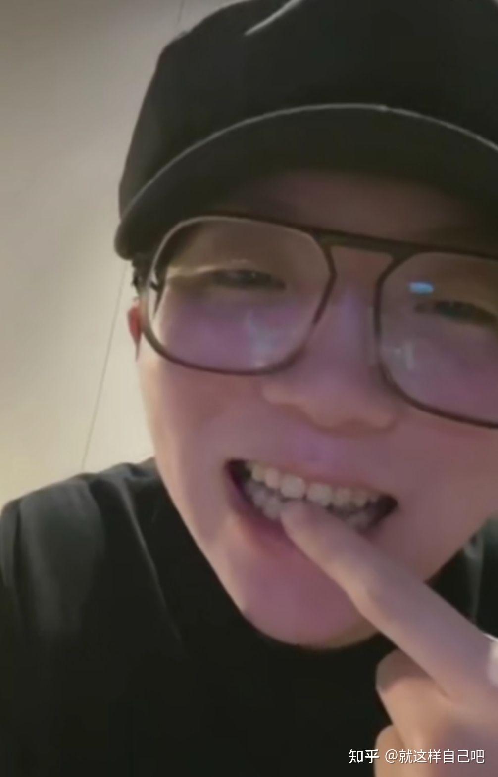 毛不易的牙是怎么了是吸毒造成的吗