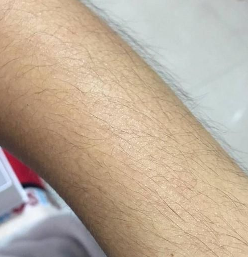 每天擦身体乳会长长手毛和腿毛嘛