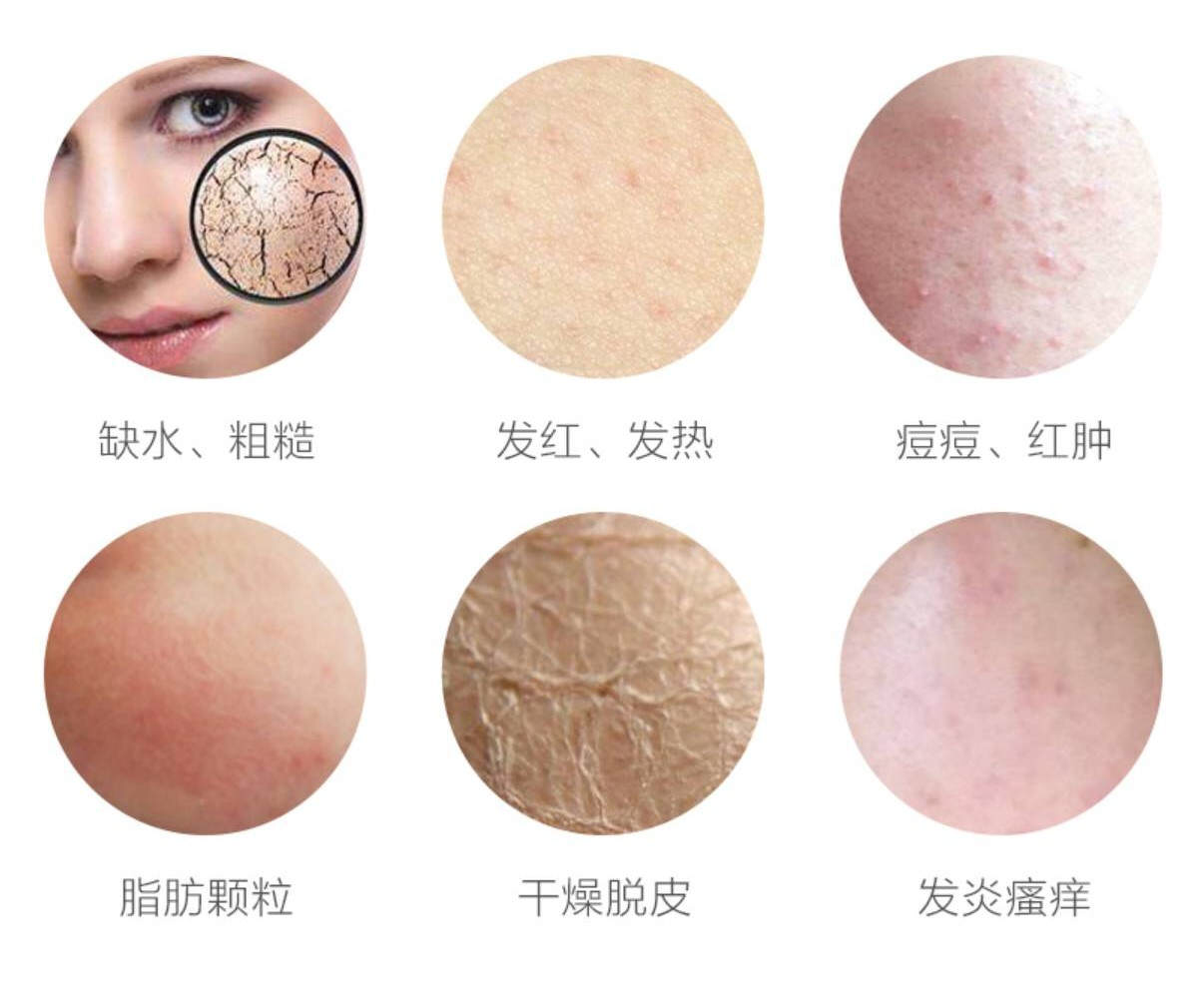 秋冬护肤!敏感肌肤到底要如何修复??