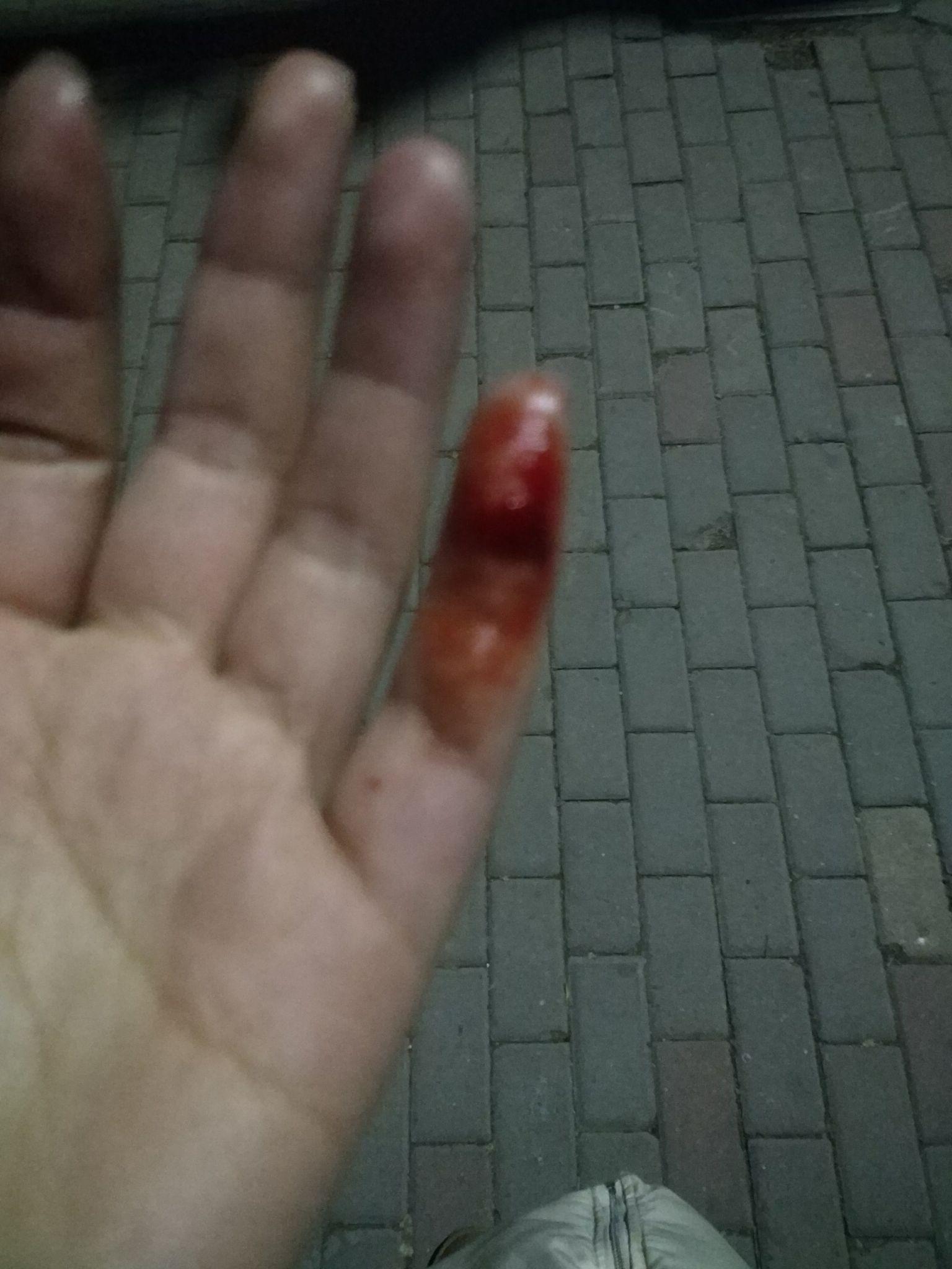 修眉刀割到手出血后要怎么处理啊?急求! - 知乎