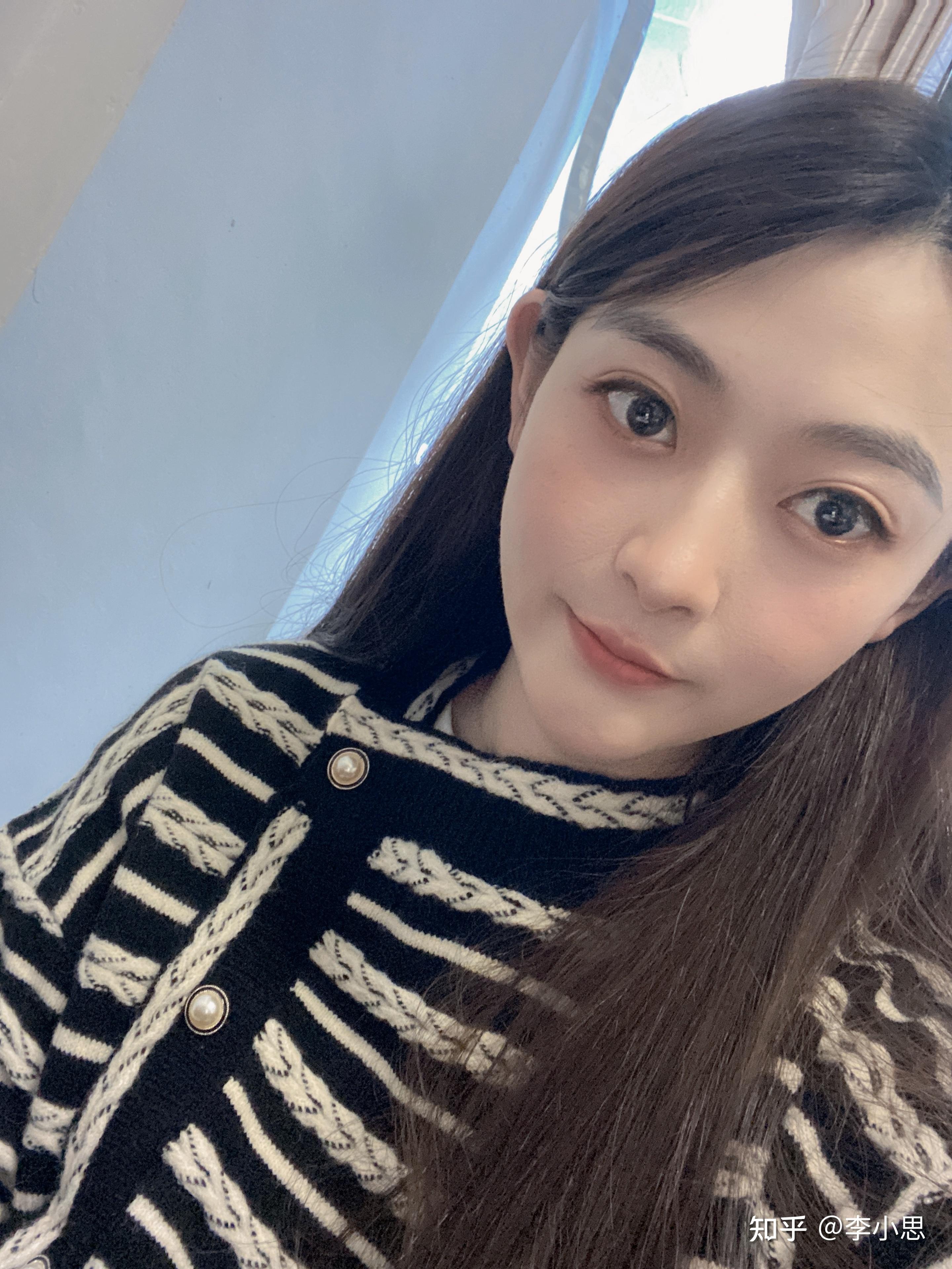 吃糖皮质激素引起的满月脸可以完全恢复吗? - 知乎