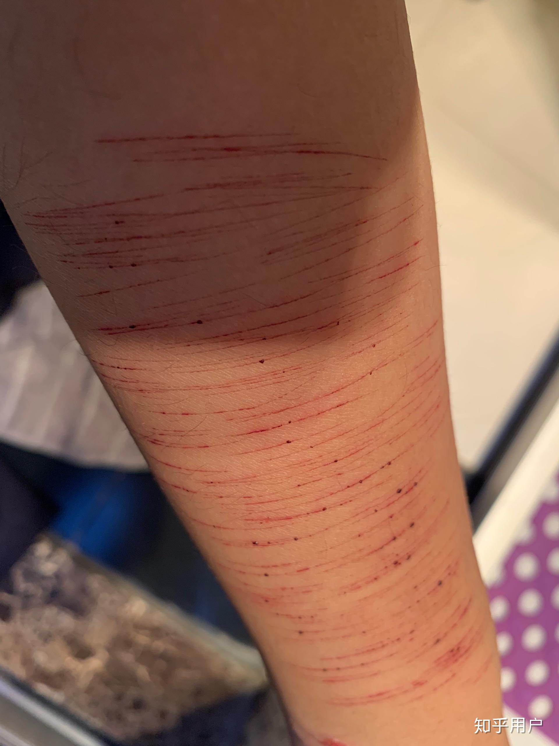 自残属于什么心理