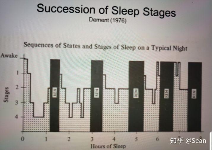 做夢是快速眼動狀態嗎深度睡眠是什麼狀態做夢的時候是深度睡眠嗎什麼