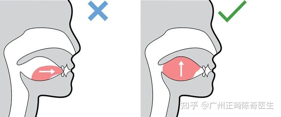 舌头的正确安放位置? - 知乎
